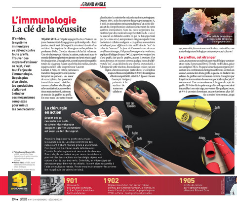 Infographie 3D médicale - greffe de main