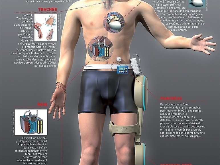 Reconstruction de corps humain - infographie-3d